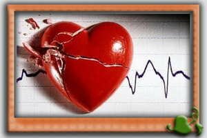 Инфаркт миокарда признаки