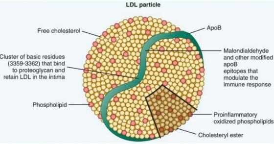 Липопротеин низкой плотности (ЛПНП) при атеросклерозе и заболеваниях сердца