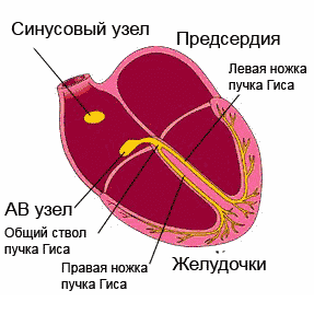 Блокада проводящей системы сердца