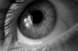 Гипертония и сетчатки глаза