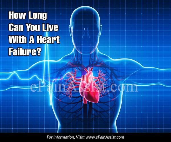 Как долго вы можете жить с сердечной недостаточностью