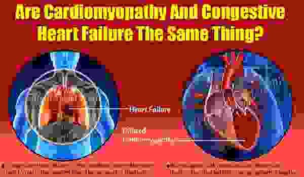 Являются ли кардиомиопатия и сердечная недостаточность одинаковыми