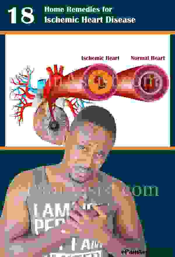 Ишемическая болезнь сердца: домашние средства, натуральные добавки, изменения образа жизни