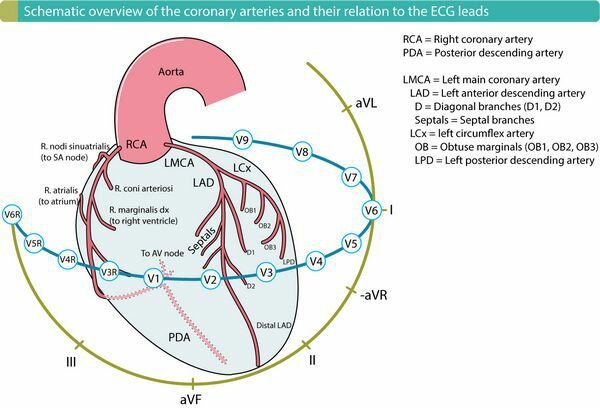 ЭКГ локализация инфаркта миокарда