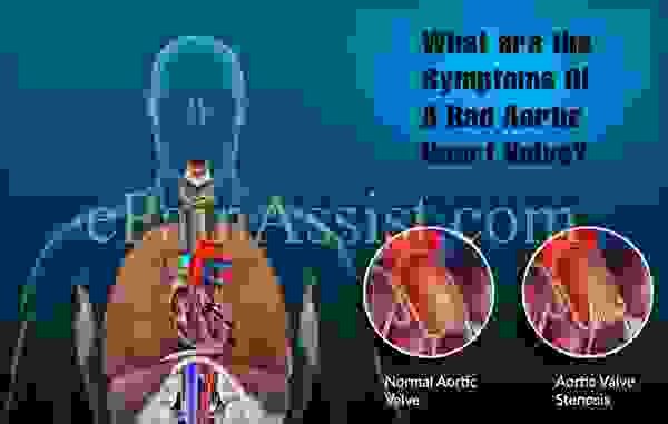 Каковы симптомы плохого аортального сердечного клапана