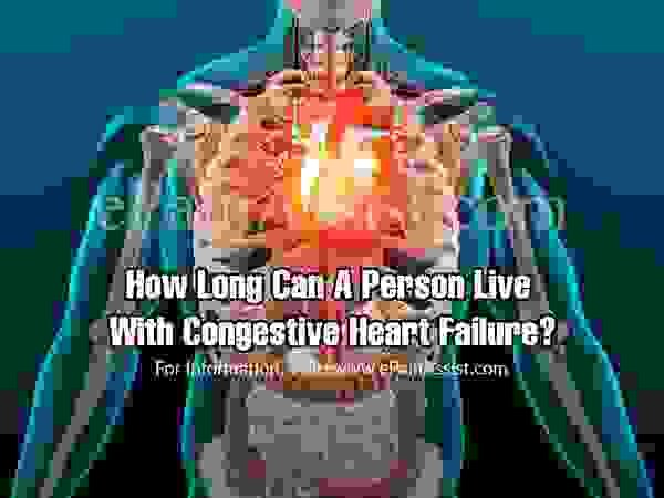 Как долго человек может жить с застойной сердечной недостаточностью