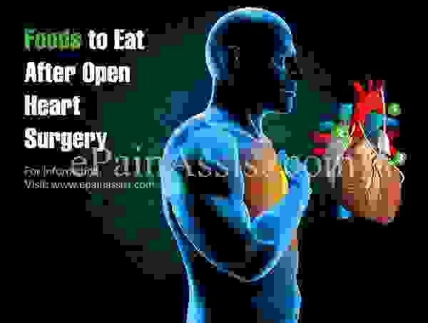 Диета после открытой кардиохирургии, продукты для еды — продукты, которых следует избегать после открытой кардиохирургии